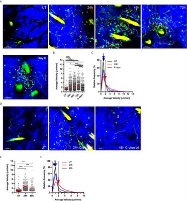 Dynamic Regulation of the Molecular Mechanisms of Regulatory T Cell Migration in Inflamed Skin